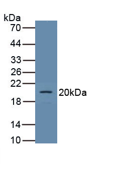 Polyclonal Antibody to Podocalyxin (PCX)
