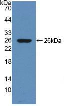 Polyclonal Antibody to Cholinergic Receptor, Muscarinic 1 (CHRM1)