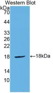 Polyclonal Antibody to Cytotoxic T-Lymphocyte Associated Antigen 4 (CTLA4)
