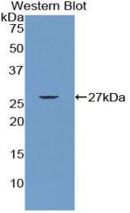 Polyclonal Antibody to Immunoglobulin Associated Beta (Igb)