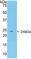 Polyclonal Antibody to Protocadherin Beta 2 (PCDHb2)