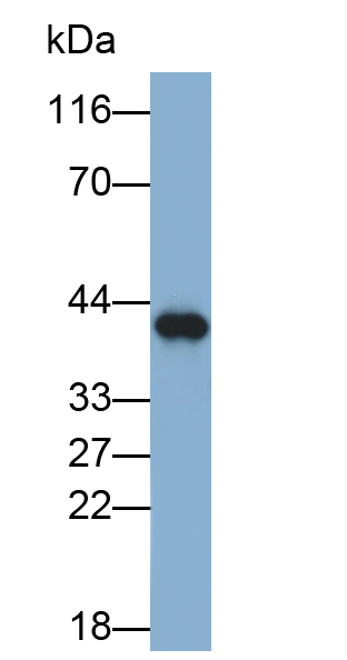 Polyclonal Antibody to Tumor Necrosis Factor Receptor 1 (TNFR1)