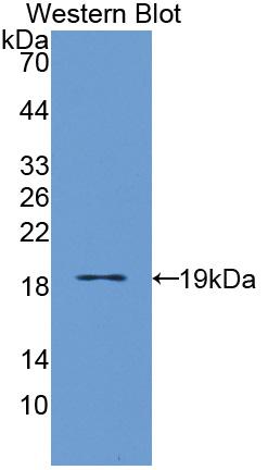 Polyclonal Antibody to Interleukin 3 Receptor Alpha (IL3Ra)