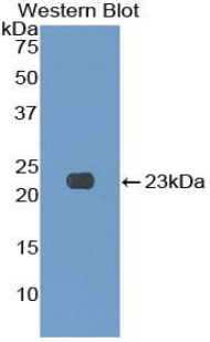 Polyclonal Antibody to Killer Cell Lectin Like Receptor Subfamily C, Member 2 (KLRC2)
