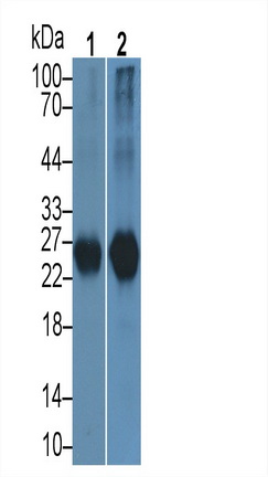 Polyclonal Antibody to Protease, Serine 2 (PRSS2)