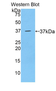 Polyclonal Antibody to B-Lymphocyte Chemoattractant 1 (BLC1)