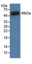 Polyclonal Antibody to Nuclear Receptor Subfamily 3, Group C, Member 1 (NR3C1)