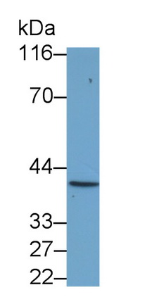 Polyclonal Antibody to Chemokine C-C-Motif Receptor 7 (CCR7)