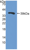 Polyclonal Antibody to Trefoil Factor 3, Intestinal (TFF3)