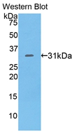 Polyclonal Antibody to Lymphocyte Antigen 9 (LY9)