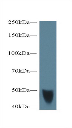 Polyclonal Antibody to Transglutaminase 1, Keratinocyte (TGM1)