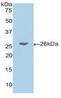 Polyclonal Antibody to Jagged 1 Protein (JAG1)