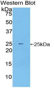 Polyclonal Antibody to Fibroblast Growth Factor Receptor Substrate 2 (FRS2)