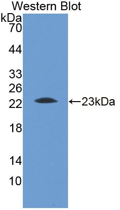 Polyclonal Antibody to Apolipoprotein M (APOM)