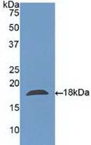 Polyclonal Antibody to Charcot Leyden Crystal Protein (CLC)