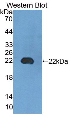 Polyclonal Antibody to Uridine Monophosphate Synthetase (UMPS)