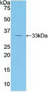 Polyclonal Antibody to RAR Related Orphan Receptor Gamma (RORg)