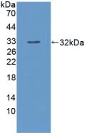 Polyclonal Antibody to Hydroxymethylbilane Synthase (HMBS)