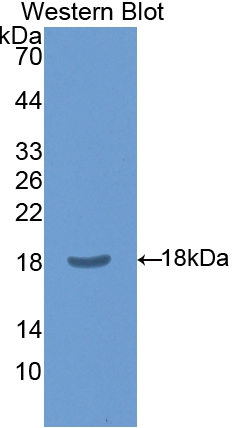 Polyclonal Antibody to Chloride Intracellular Channel Protein 4 (CLIC4)