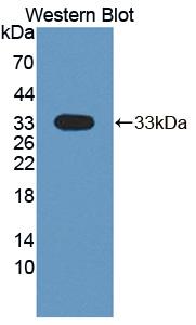Polyclonal Antibody to Dual Serine/Threonine And Tyrosine Protein Kinase (DSTYK)