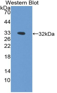 Polyclonal Antibody to Palmitoyl Protein Thioesterase 1 (PPT1)