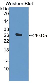 Polyclonal Antibody to Carnosine Synthase 1 (CARNS1)