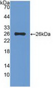 Polyclonal Antibody to T-Cell Immunoreceptor With Ig And ITIM Domains Protein (TIGIT)