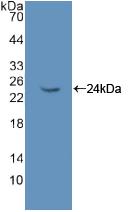 Polyclonal Antibody to Non Metastatic Cells 6, Protein Expressed In (NME6)