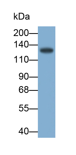 Polyclonal Antibody to Sp140 Nuclear Body Protein (SP140)
