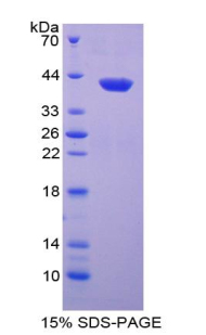 Recombinant Neutrophil Activating Protein 3 (NAP3)