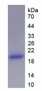 Recombinant Leptin (LEP)