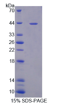 Recombinant Macrophage Inflammatory Protein 1 Beta (MIP1b)
