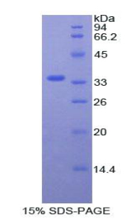 Recombinant Staphylococcal Protein A (SPA)