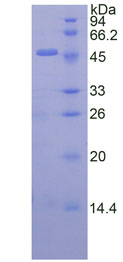 Recombinant Interferon Beta (IFNb)