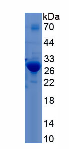 Recombinant Cardiac Troponin I (cTnI)