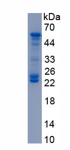 Recombinant Immunoglobulin M (IgM)