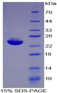 Recombinant Interleukin 1 Beta (IL1b)