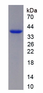 Recombinant Adiponectin (ADP)