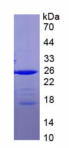 Recombinant V-Rel Reticuloendotheliosis Viral Oncogene Homolog A (RELA)