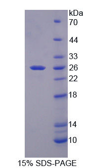 Recombinant Heat Shock 27kDa Protein 1 (HSPB1)