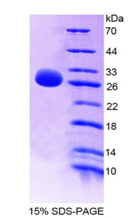 Recombinant Programmed Cell Death Protein 1 Ligand 1 (PDL1)