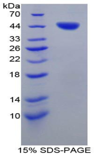 Recombinant Tryptase (TPS)