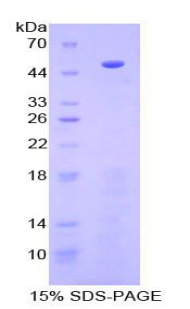 Recombinant Procollagen C Proteinase Enhancer 1 (PCPE1)