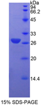 Recombinant Actin Alpha 2, Smooth Muscle (ACTa2)