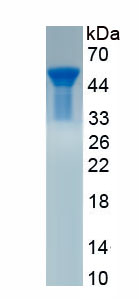 Recombinant Elastase 1, Pancreatic (ELA1)