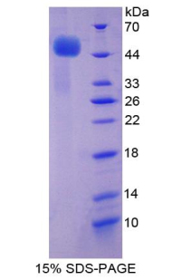 Recombinant Tumor Necrosis Factor Receptor 1 (TNFR1)