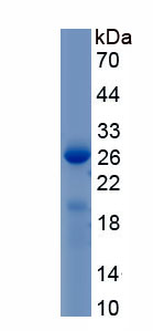 Recombinant Tumor Necrosis Factor Receptor Superfamily, Member 1B (TNFRSF1B)