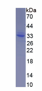Recombinant Cluster Of Differentiation 19 (CD19)