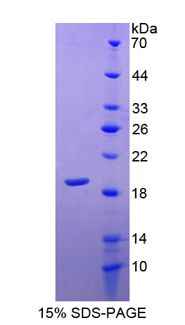 Recombinant Superoxide Dismutase 1, Soluble (SOD1)