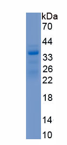 Recombinant Telomerase Reverse Transcriptase (TERT)